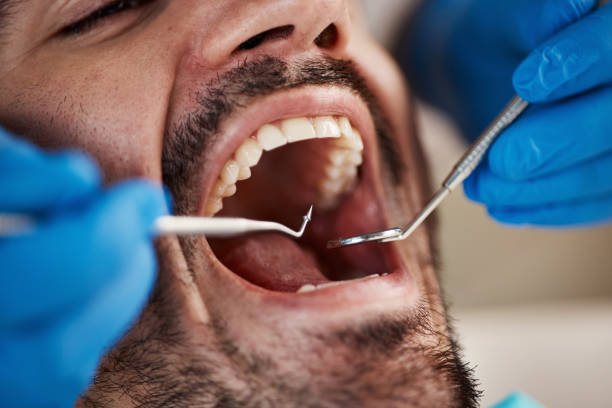 Best Emergency Gum Treatment in Fargo, ND